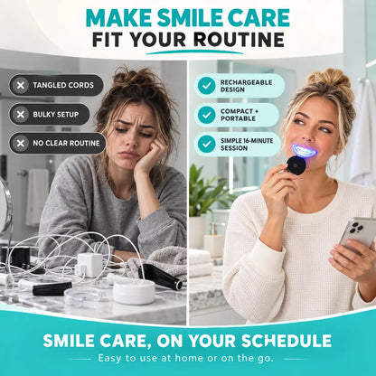Beautnexa® 🦷 Rechargeable LED Smile Kit